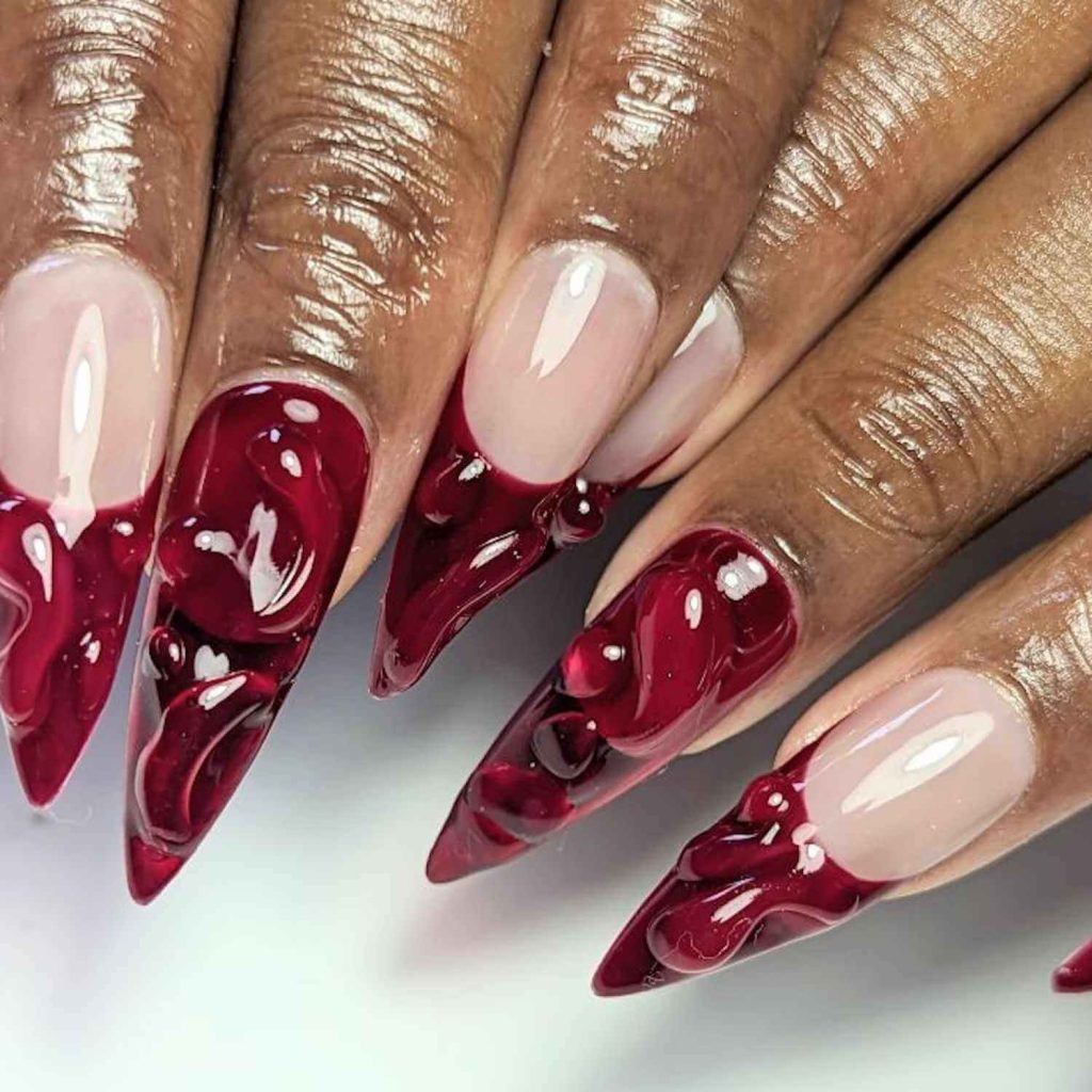 Scarlet Fever
